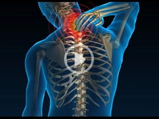 Illustration of a human skeleton with emphasis on the neck area, highlighted in red to indicate pain or tension. A person is shown holding their neck, and a play button is superimposed in the center, suggesting physical therapy NYC as a solution for effective pain management.