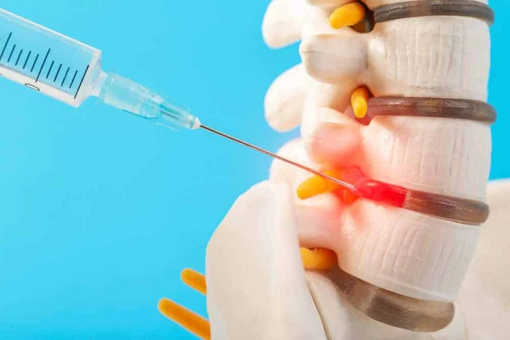 A syringe is injecting into a model of a human spine, focusing on pain management NYC. The needle targets a section highlighted in red, indicating a specific area. The spine model displays distinct vertebrae and intervertebral discs, set against a calming blue backdrop.