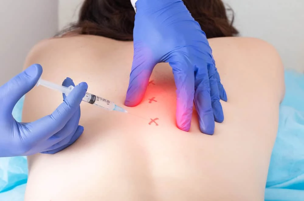 A person lies face down as another, wearing blue gloves, prepares to give an injection in the back marked with red Xs under a red light. This procedure is part of comprehensive pain management NYC offers to alleviate discomfort.