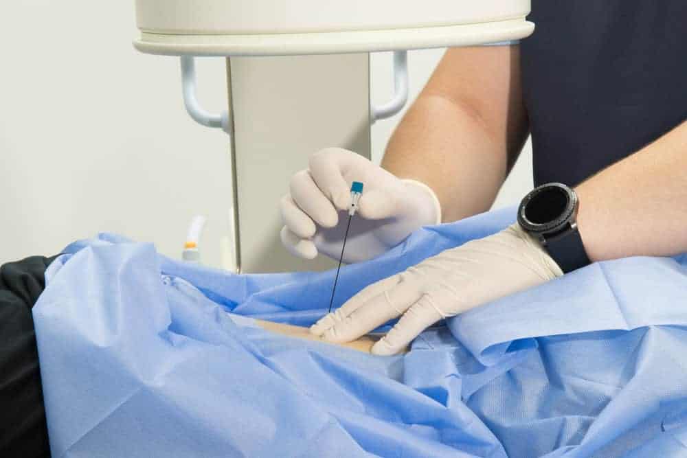 A medical professional in gloves performs a procedure, inserting a needle into a patient's abdomen covered with a blue drape. A medical machine hovers above, enhancing precision and care—key elements of pain management in NYC's top facilities.