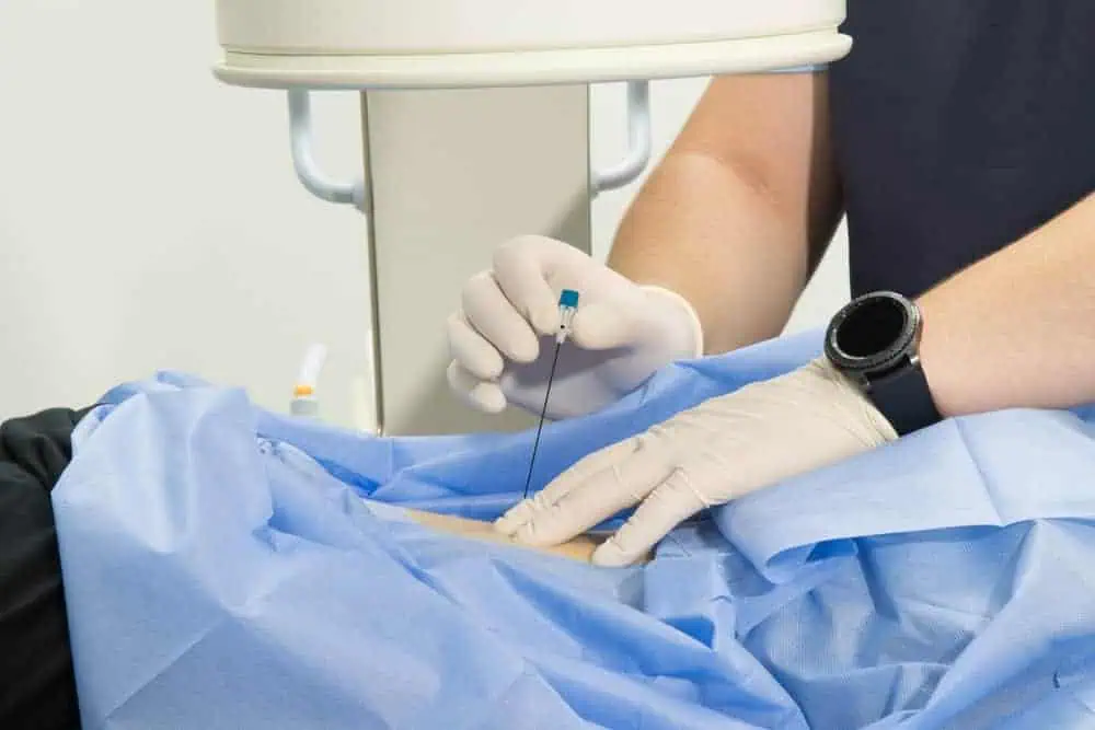 A medical professional in gloves performs a procedure, inserting a needle into a patient's abdomen covered with a blue drape. A medical machine hovers above, enhancing precision and care—key elements of pain management in NYC's top facilities.