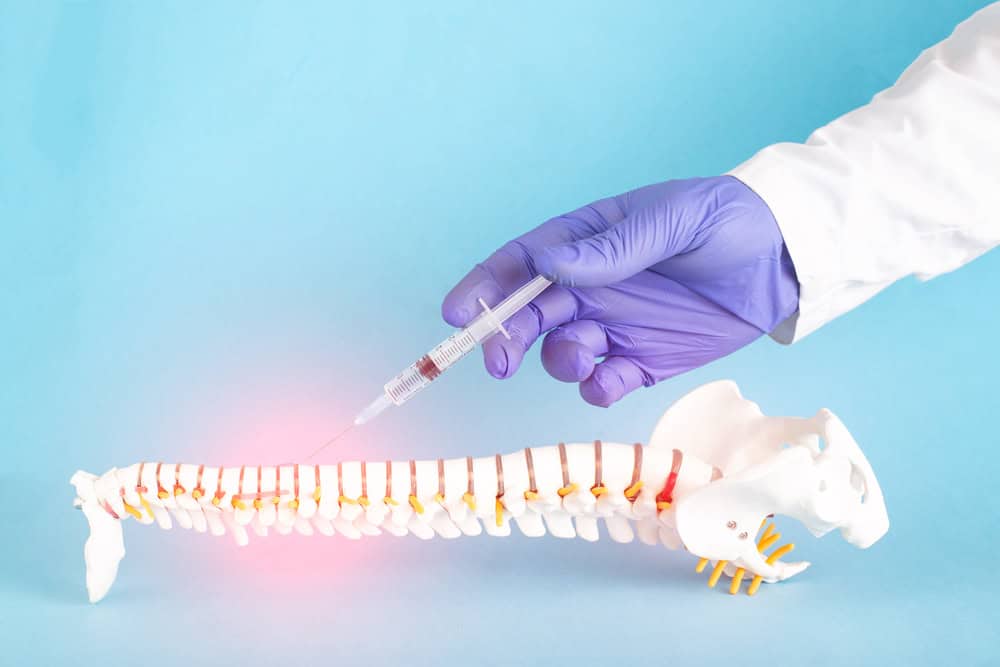 A hand in a purple glove holds a syringe, injecting into a model of a human spine against a blue background. The injection point glows pink, illustrating advanced techniques in pain management NYC or complementing physical therapy NYC methods for optimal recovery.