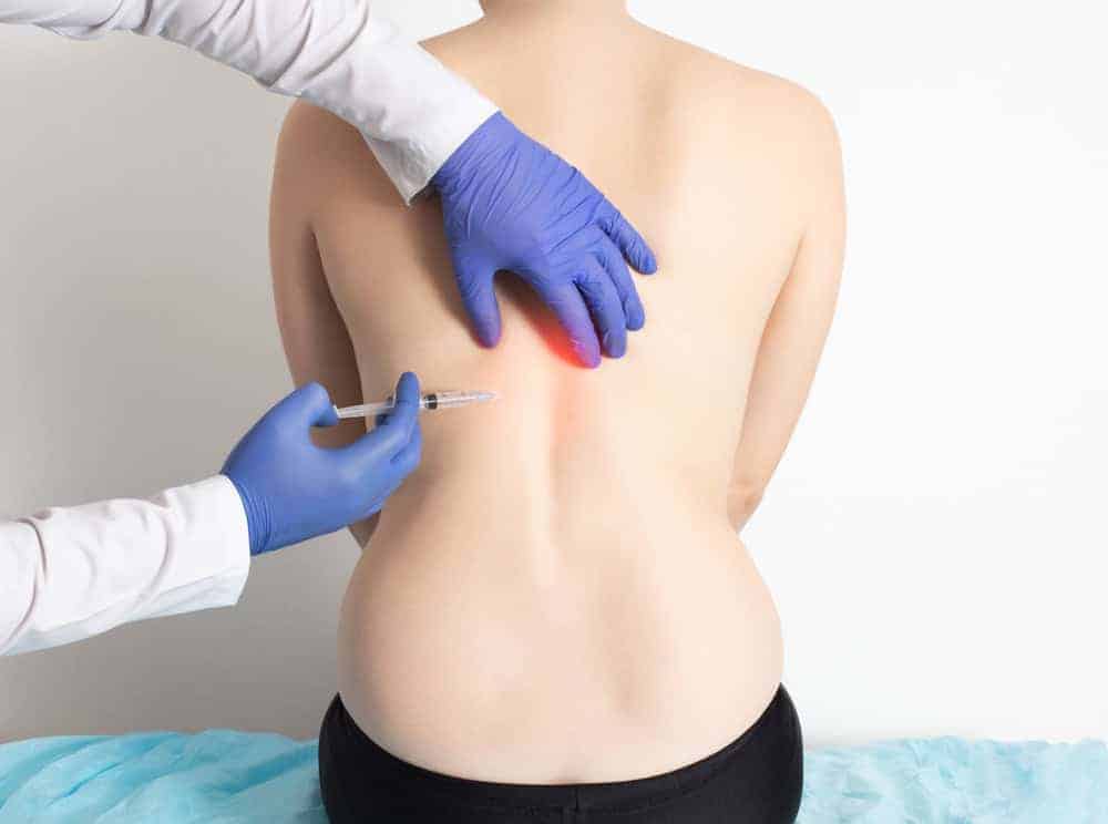 A medical professional wearing blue gloves administers an injection to a person’s back, highlighting pain management NYC. The individual sits on a blue draped surface with a red mark on their lower back, indicating the injection site crucial for effective physical therapy NYC.