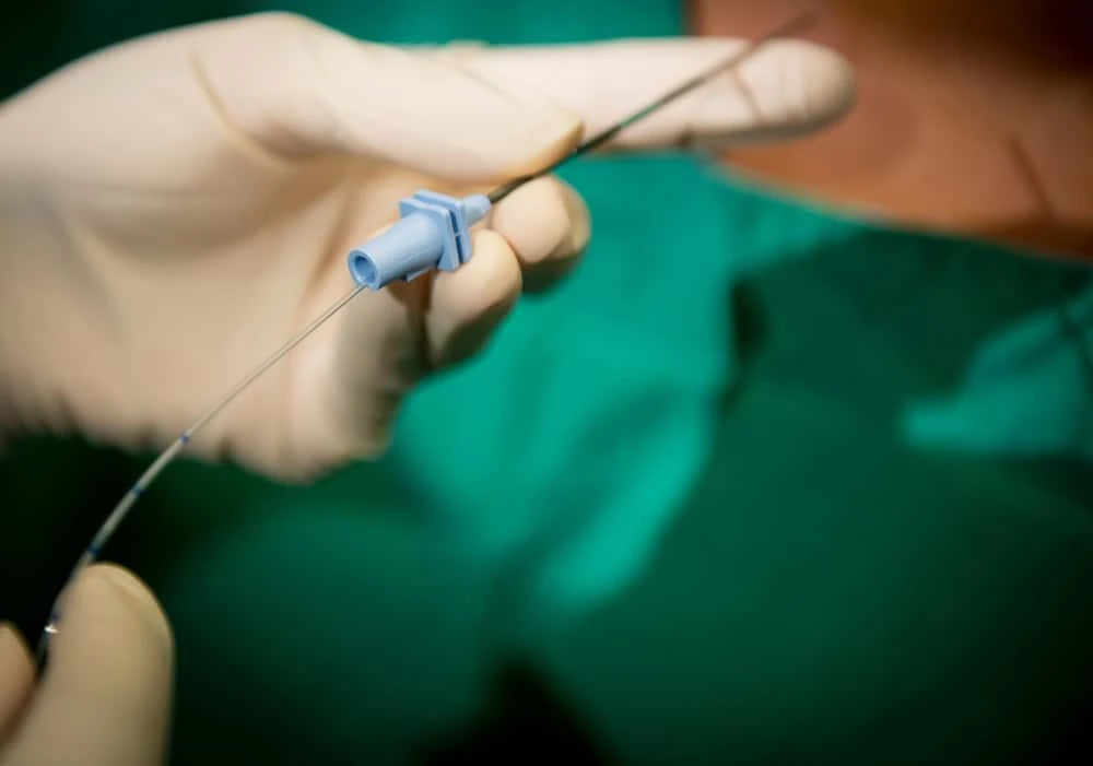 A pain management specialist in NYC administering an epidural injection to a patient’s lower back, providing targeted relief for chronic back or nerve pain.