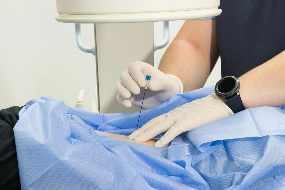 A pain management specialist in NYC performing an epidural injection procedure, using fluoroscopic guidance to deliver targeted relief for spinal and nerve-related pain.