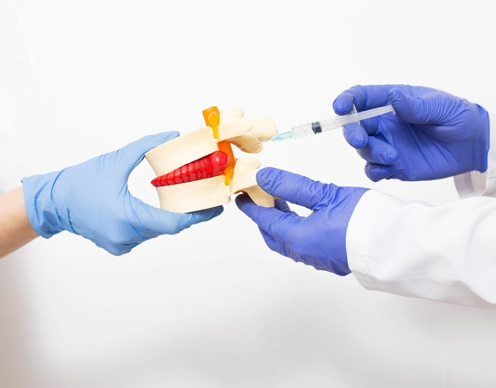 Medical simulation of a facet block injection on a dummy model, demonstrating how pain specialists in NYC target spinal joints for precise back pain relief.