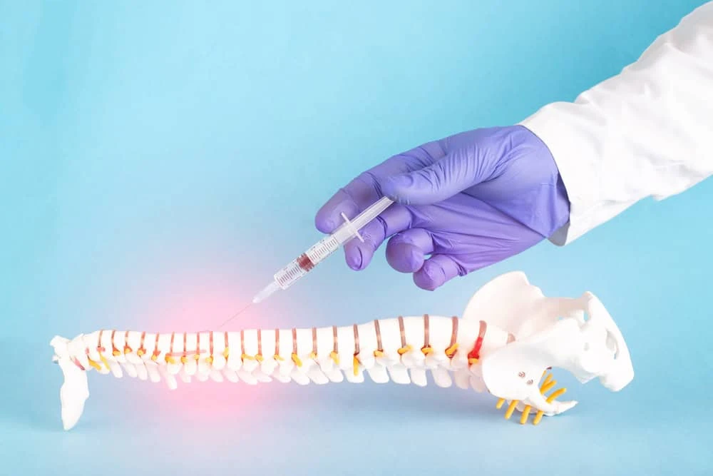A specialist from NY Spine Medicine in NYC performing a facet joint injection on a patient, using guided spinal injection techniques to deliver targeted pain relief for back and neck conditions.