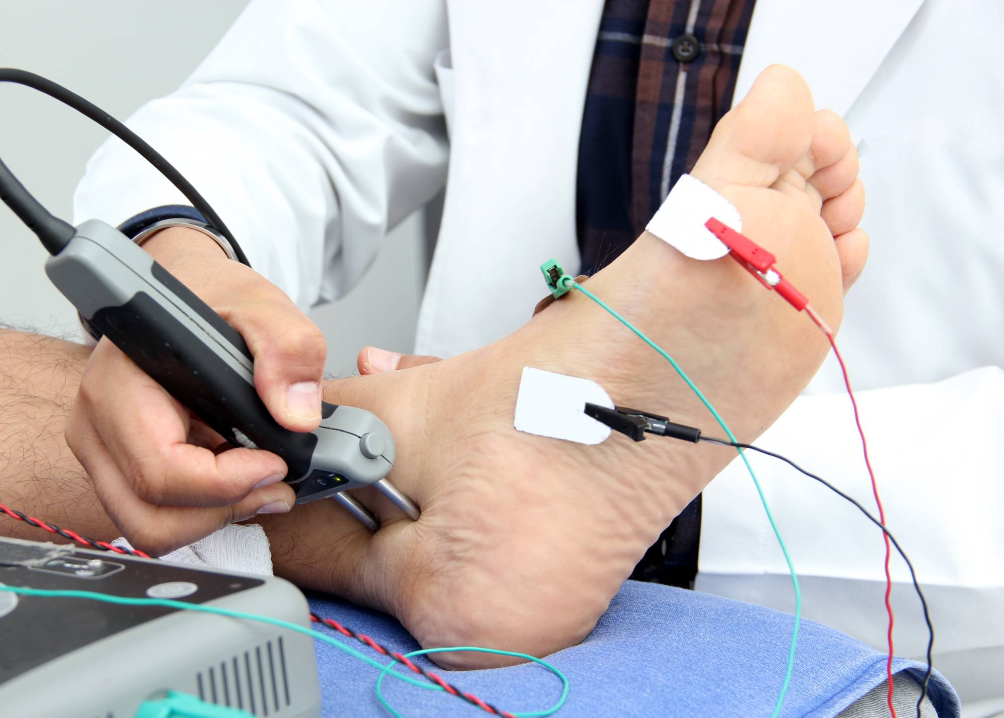 A doctor performs a nerve conduction study on a person's foot using electrodes and a handheld device; wires are attached to the foot, and medical equipment is visible nearby.